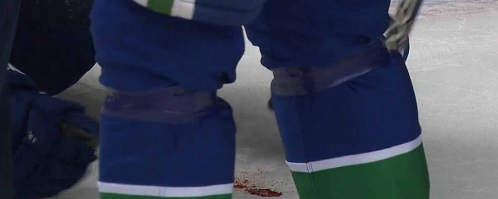Defenseman leaves a bloody mess on the ice after taking a shot to the face.