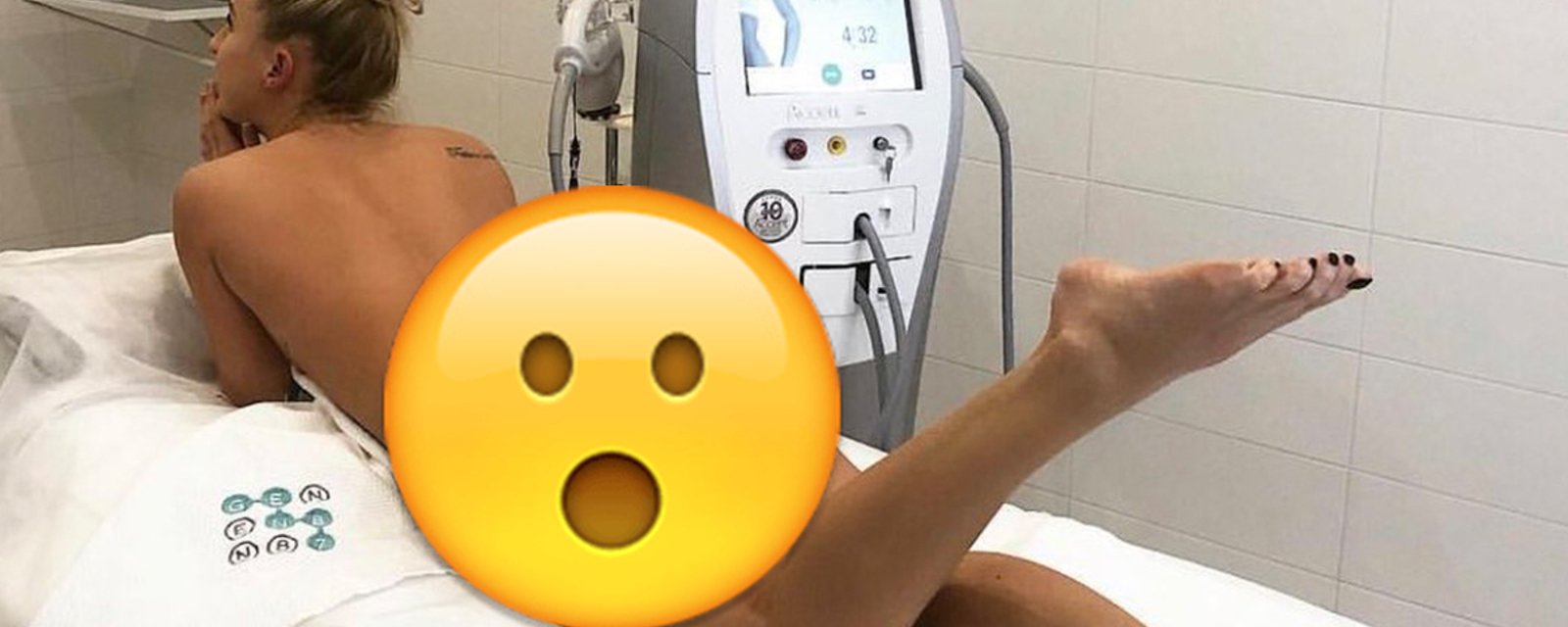 Russian women’s player announces ankle injury with NSFW photo