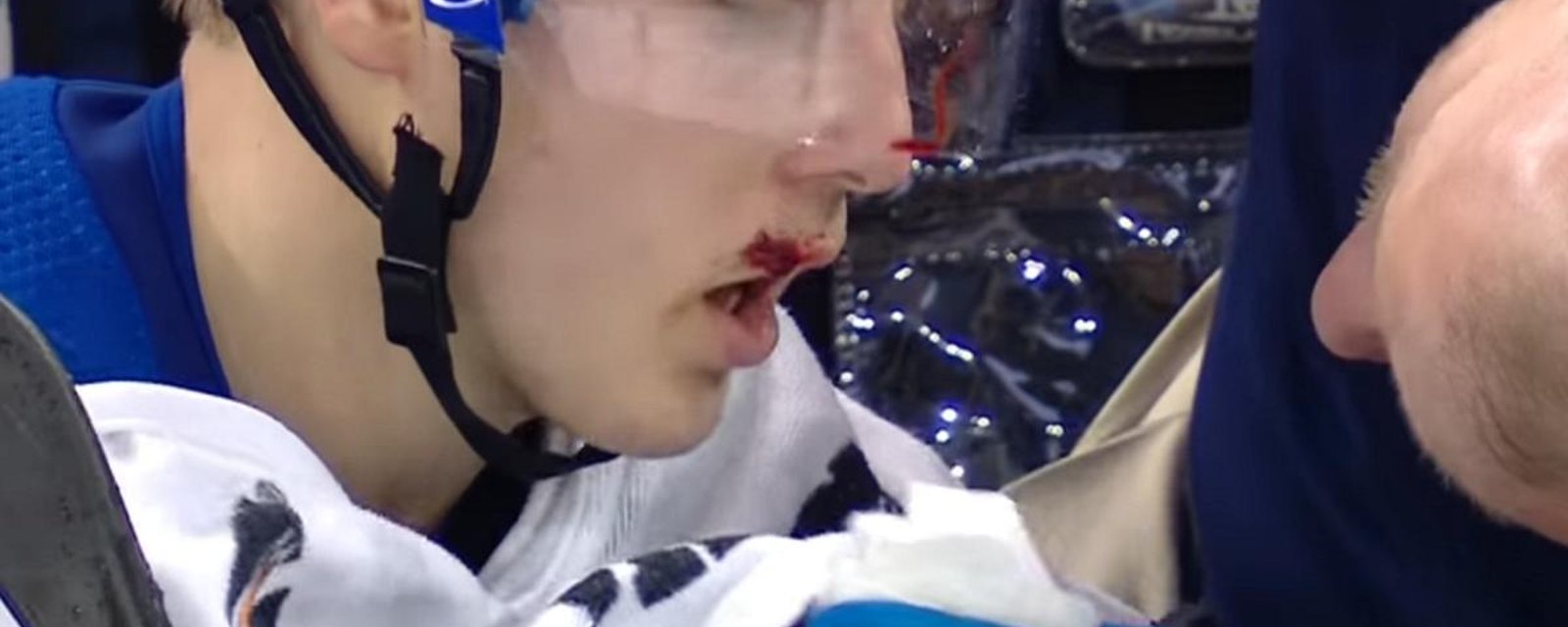 Jesper Fast is busted open after face planting on to the ice.