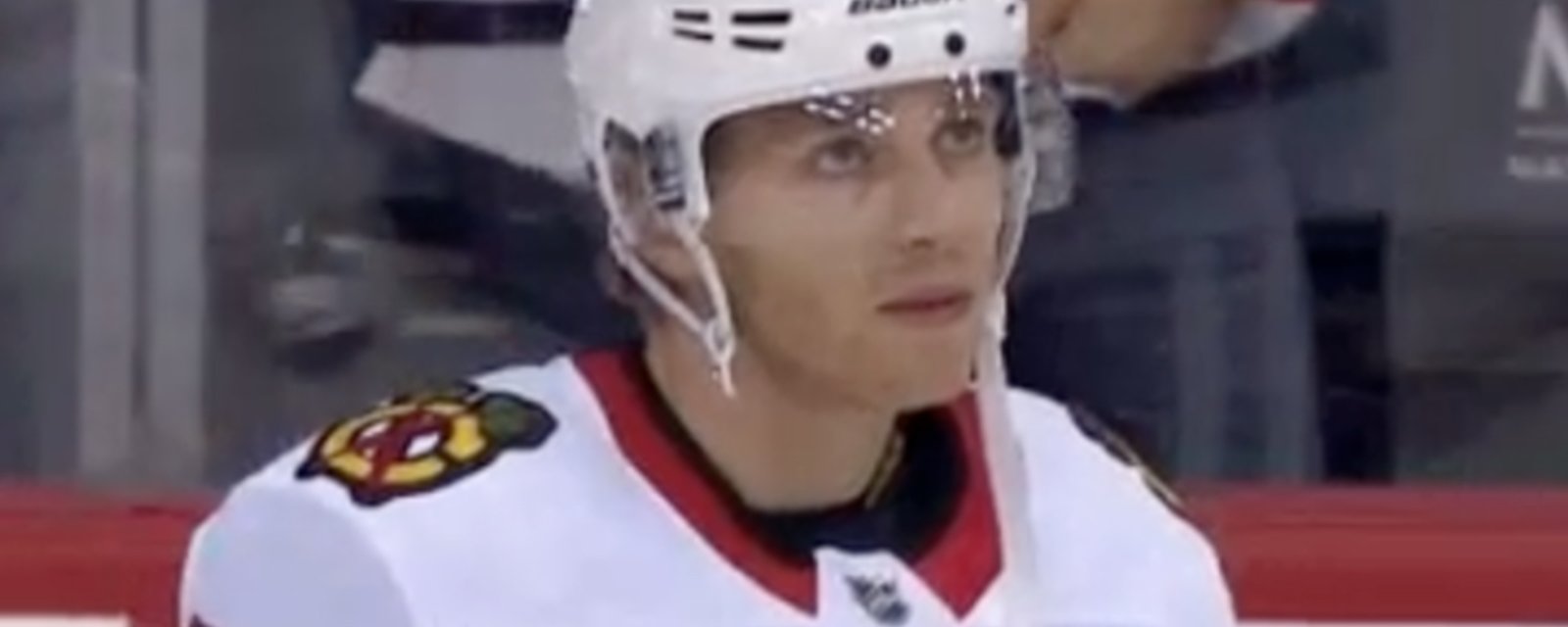 Patrick Kane gets NAILED in the face during warmup