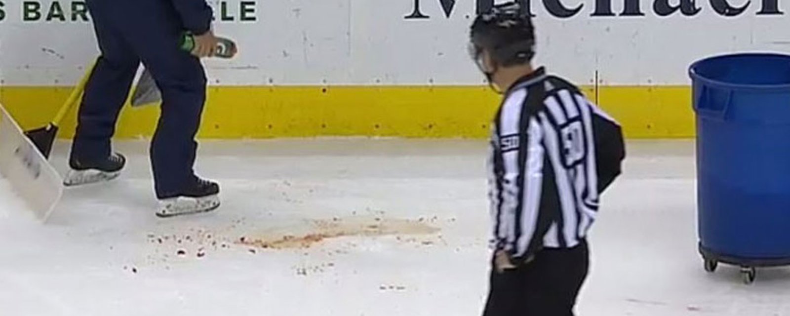 Junior player loses his upper lip after getting slap shot in the face! 