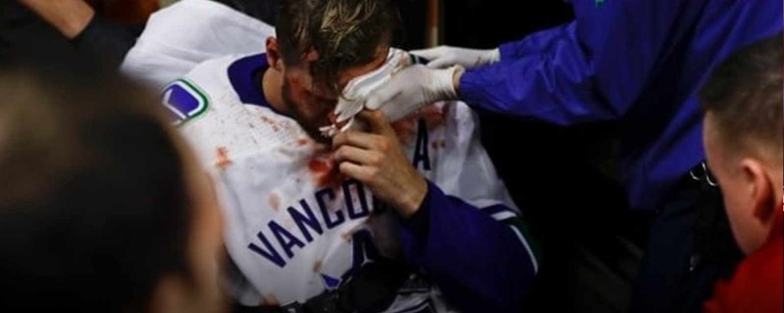 Outpouring of support for Canucks veteran Edler after terrifying injury in Philly last night