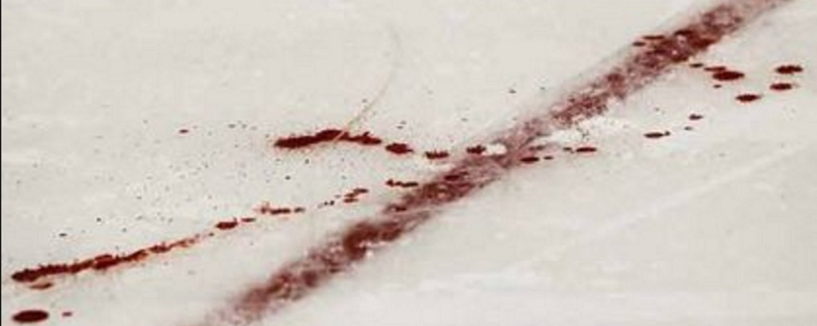 Man shot in the head after argument during children's hockey game.