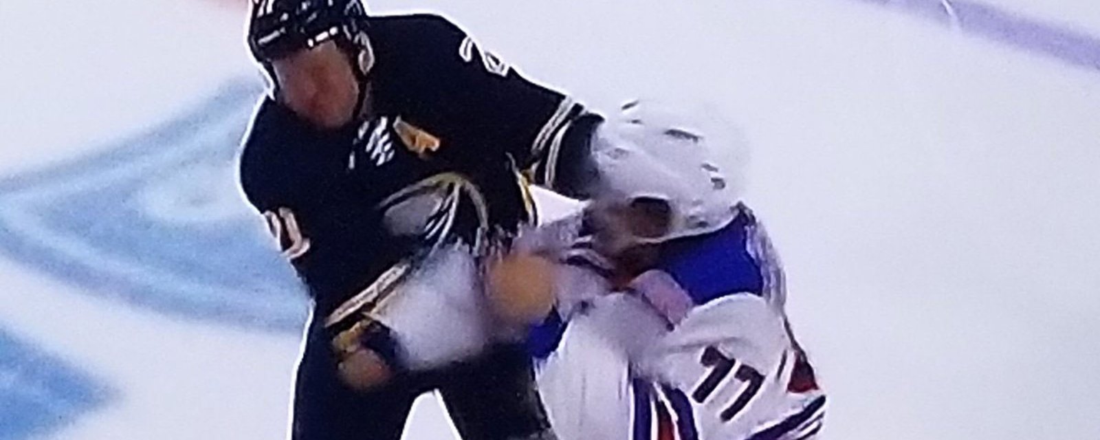 Breaking: Okposo gets knocked out with one punch and leaves the game with bloody face! 