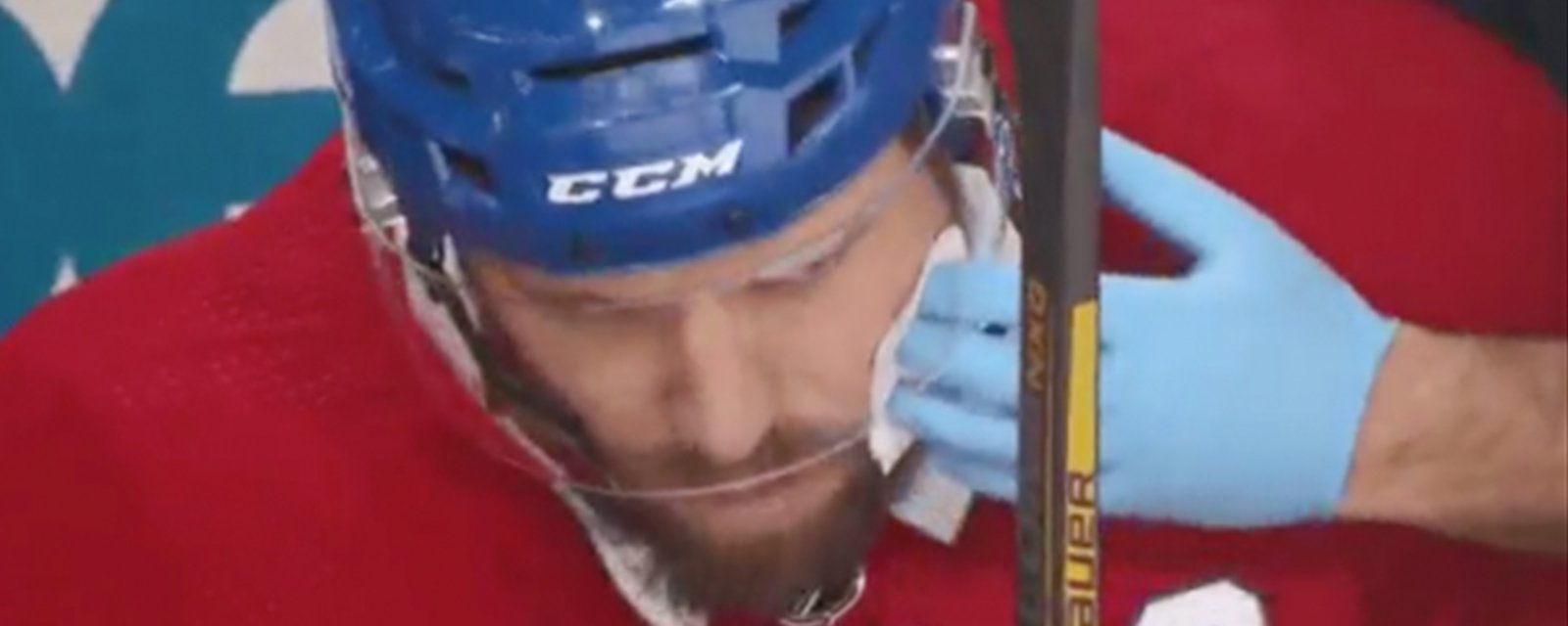 Shea Weber takes a puck to the face, is forced to leave the game