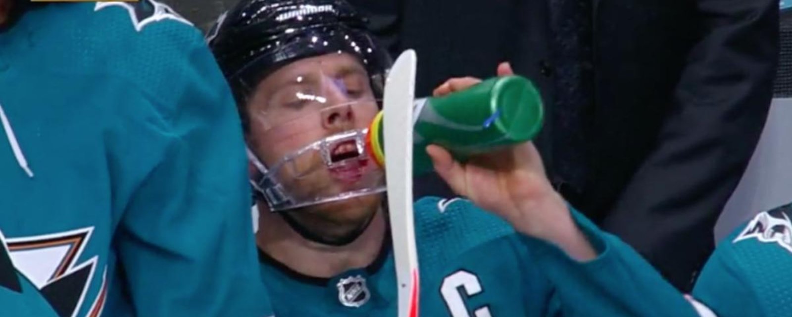 Pavelski’s teammates look for his teeth in the shovelled up snow during TV break