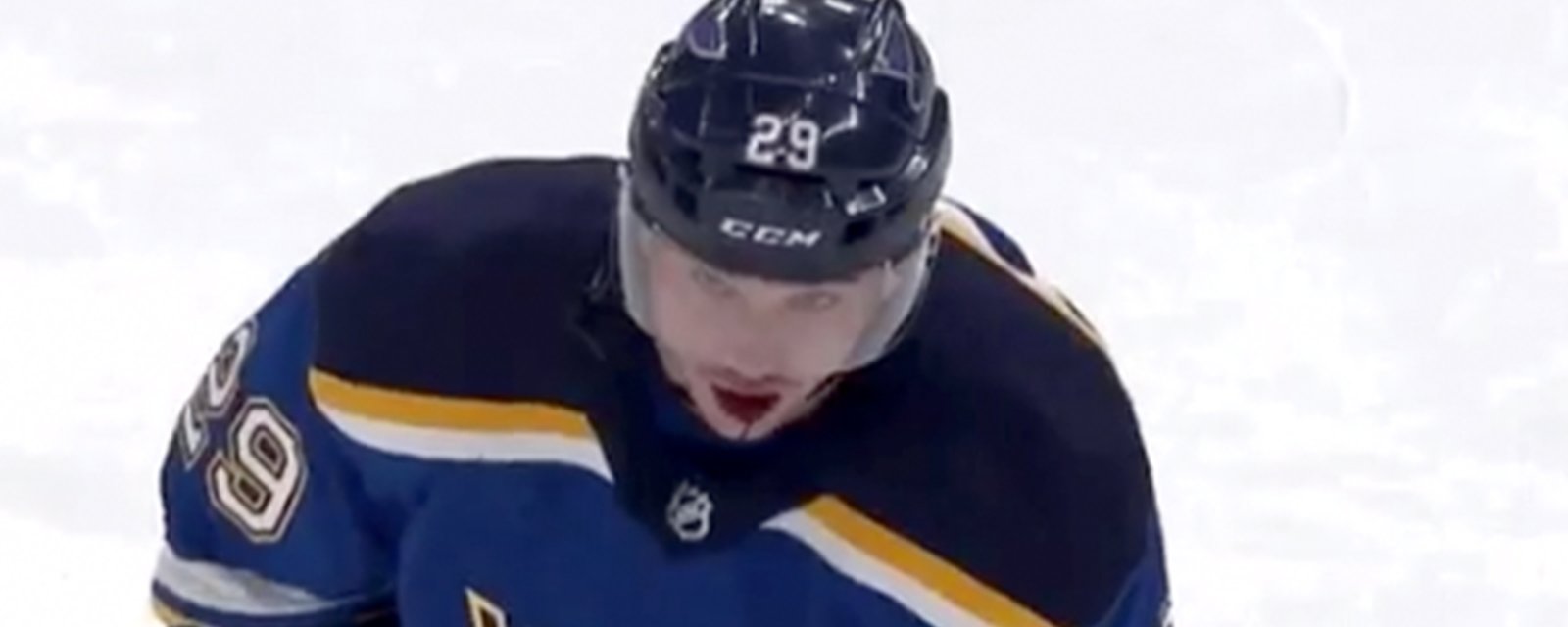 Dunn takes a puck in the face, spits blood out on the ice