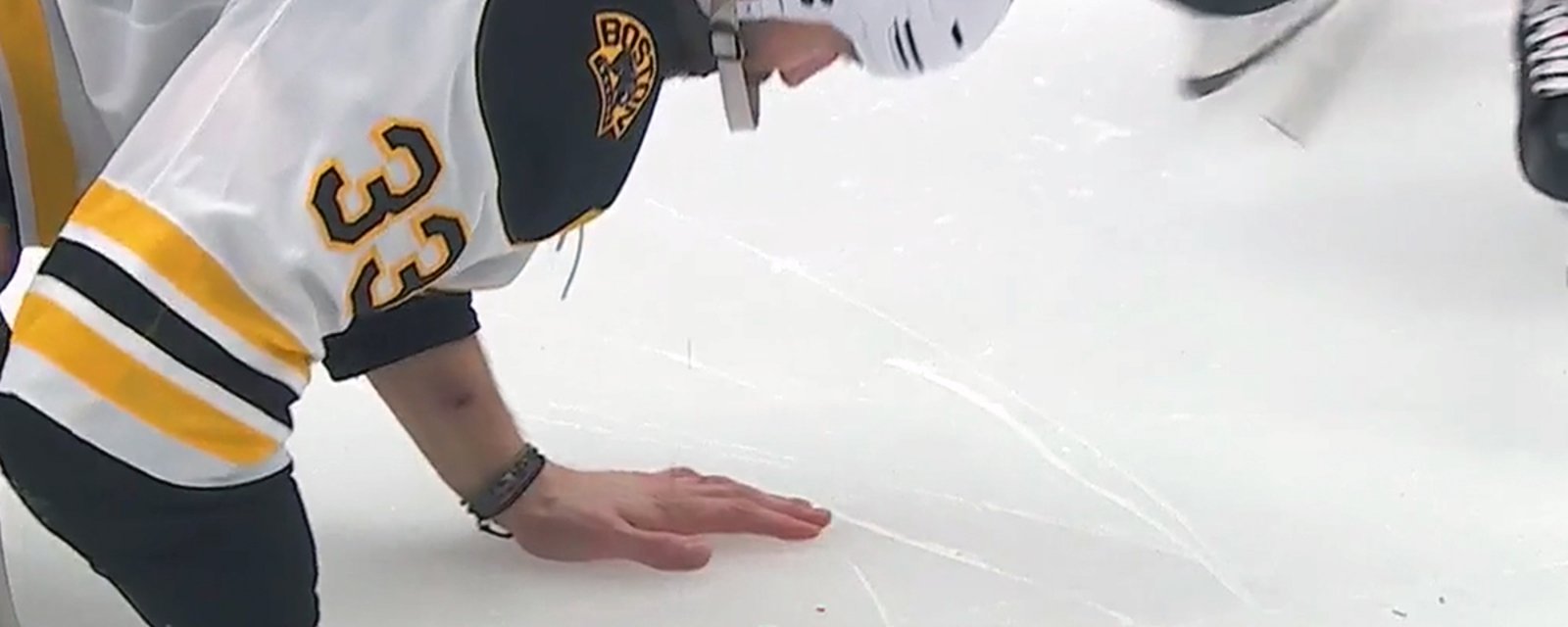A bloody Zdeno Chara is forced to leave Game 4