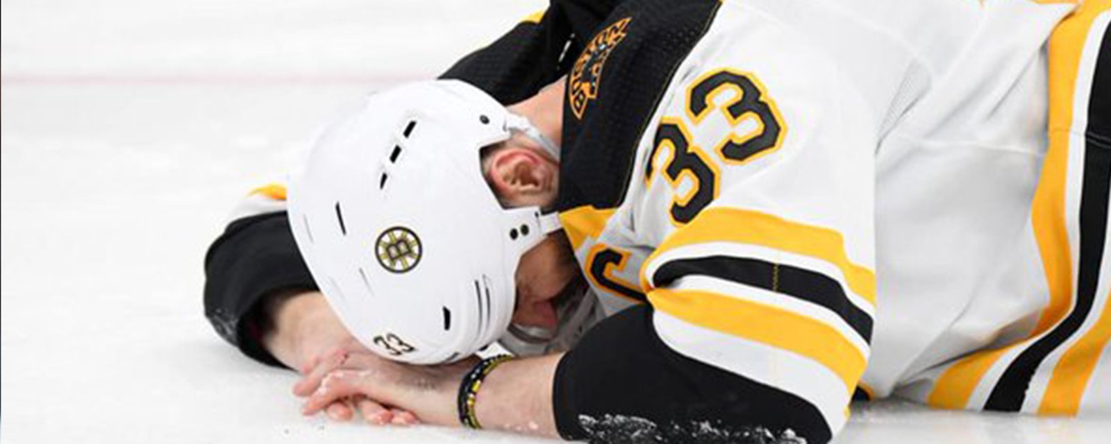 Report: Chara to play Game 5 with a broken jaw?!