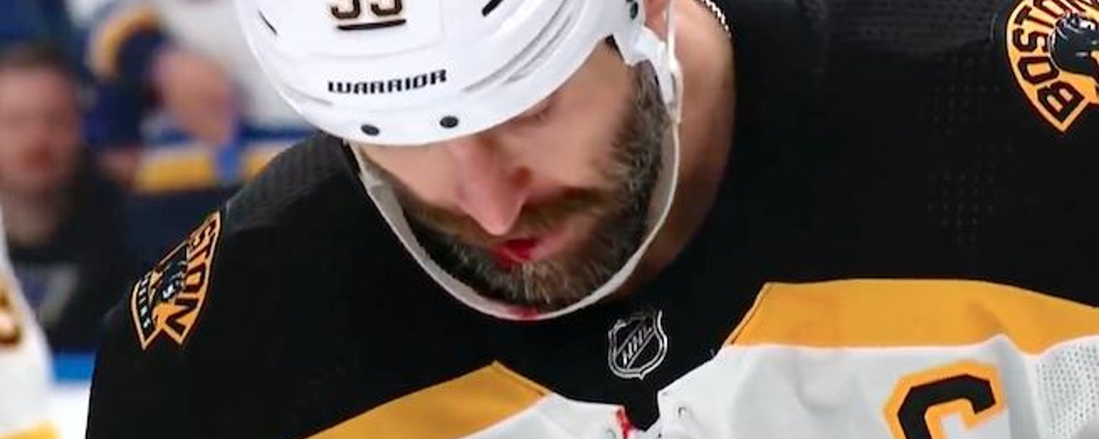 Gruesome details of Chara’s injury revealed! 