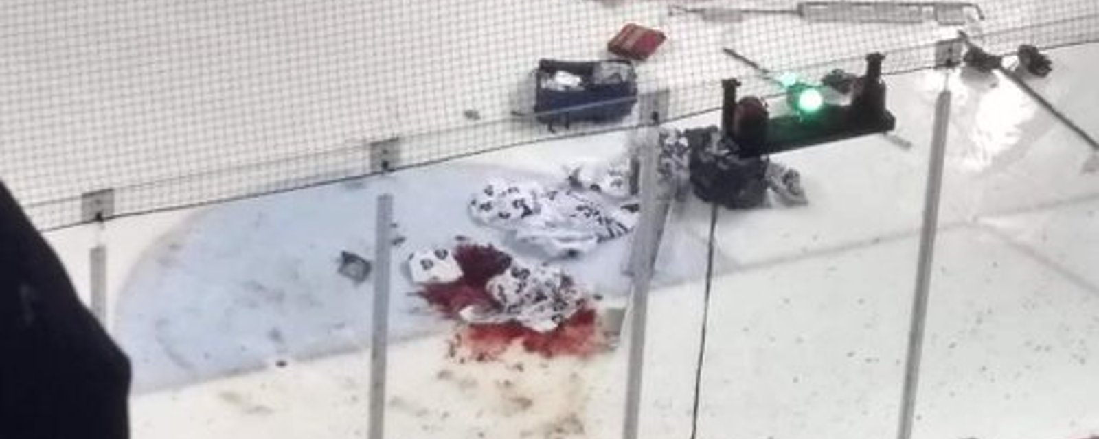 IceDogs goalie Tucker Tynan rushed to hospital after getting cut by a skate! 