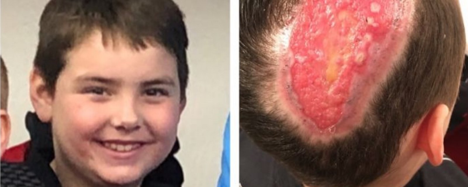 Young hockey player suffers gruesome injury in horrific attack.