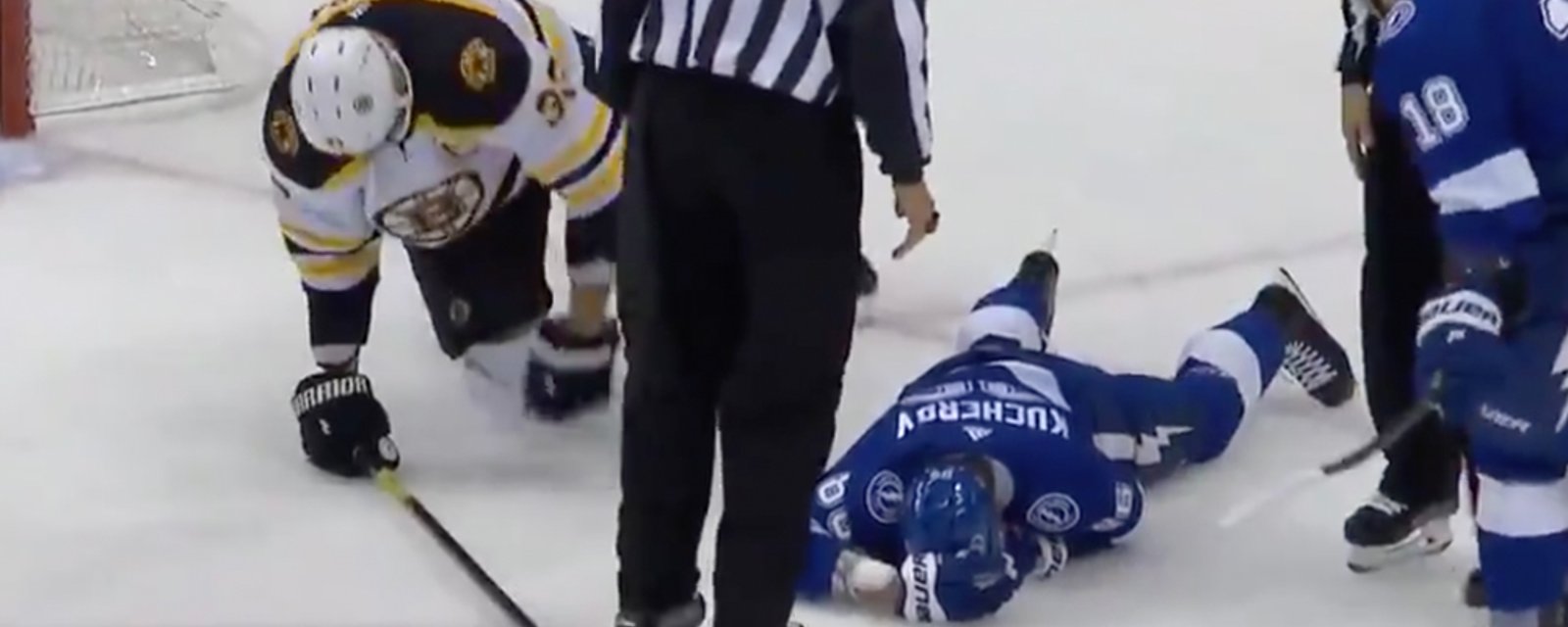 Kucherov leaves the game after taking a brutal high stick to the face from Chara