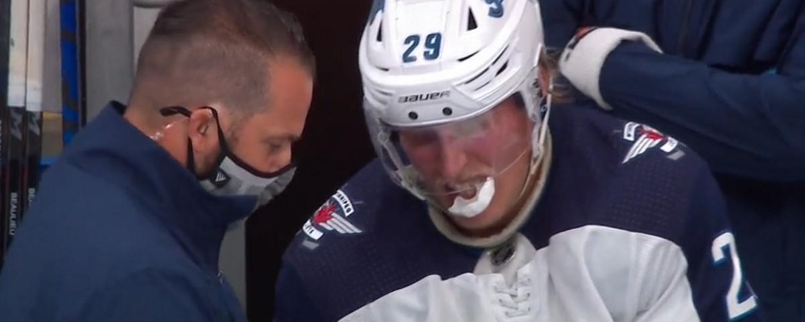 Patrik Laine leaves the game after colliding with Mark Giordano.
