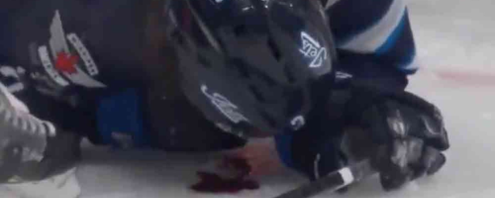 Jets’ Poolman dives face first to block shot, leaves a bloody mess! 