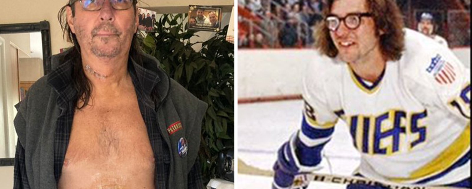 Slapshot star Jeff Carlson, one of the famous Hanson Brothers, needs your help 