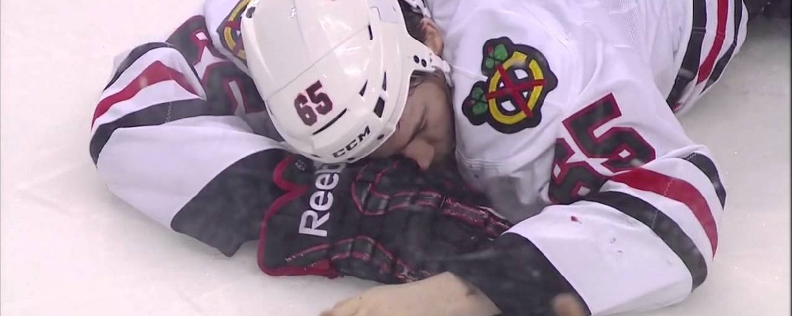 Hawks’ Shaw lands in concussion protocol again, might consider retirement instead