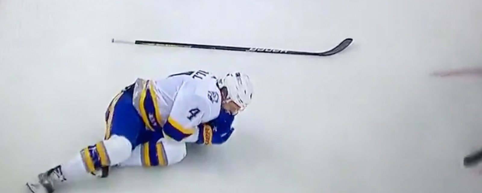 Taylor Hall takes brutal slap shot to the face! 