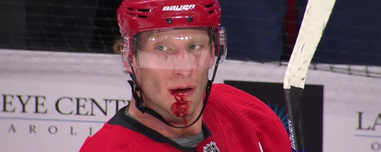 Jordan Staal busted open but goes unnoticed by NHL officials.
