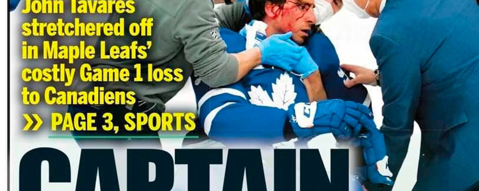 Toronto Sun and other medias in hot water over treatment of Tavares’ injury 