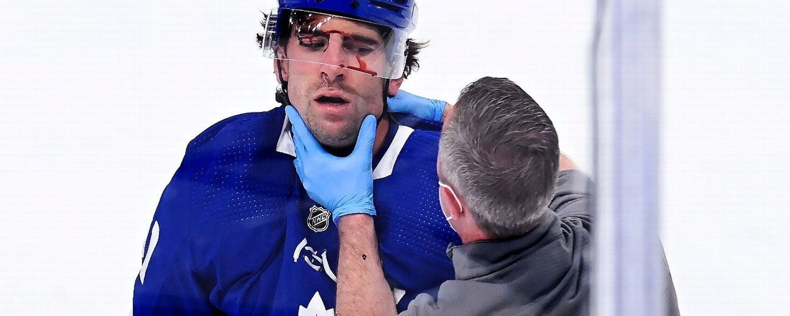 Tavares posts official statement on injury and status for series vs. Montreal 