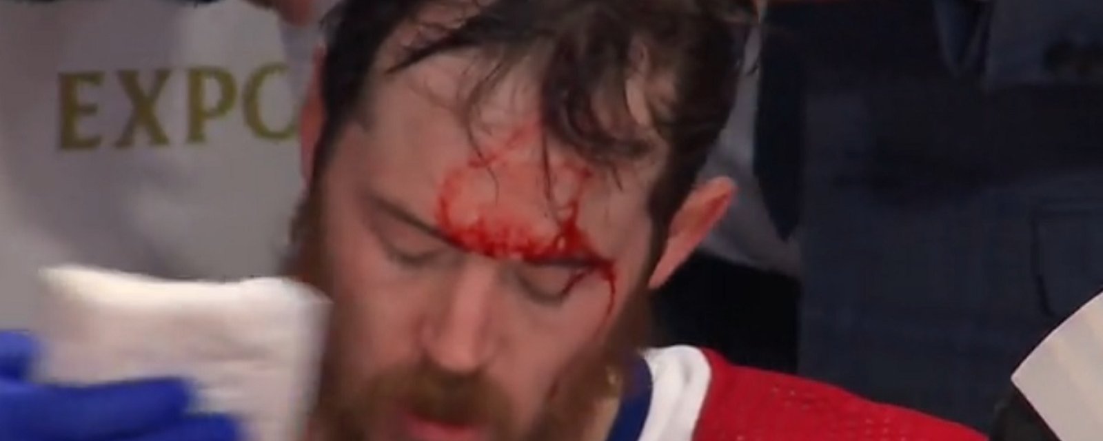 Paul Byron busted open after losing his helmet.