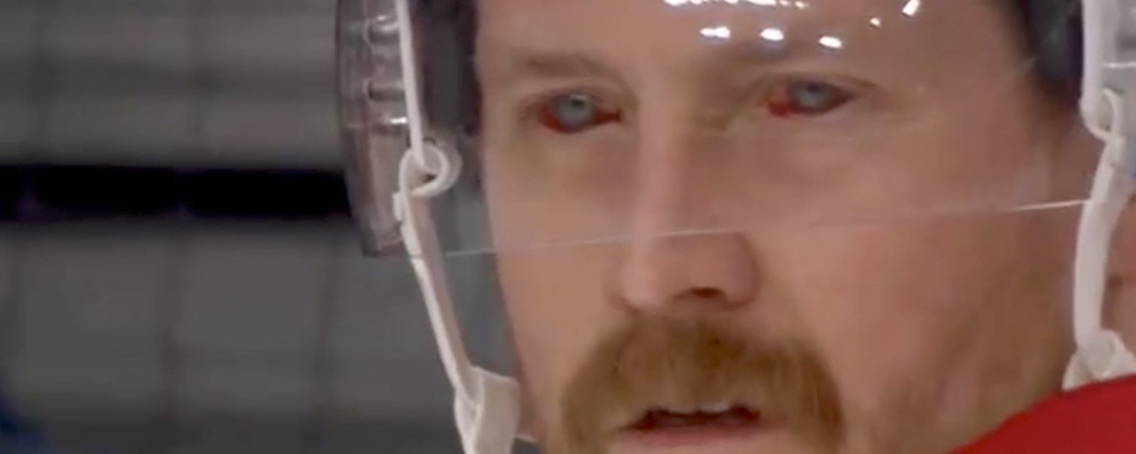 Fans can’t get over Jeff Petry’s bloodshot eyes