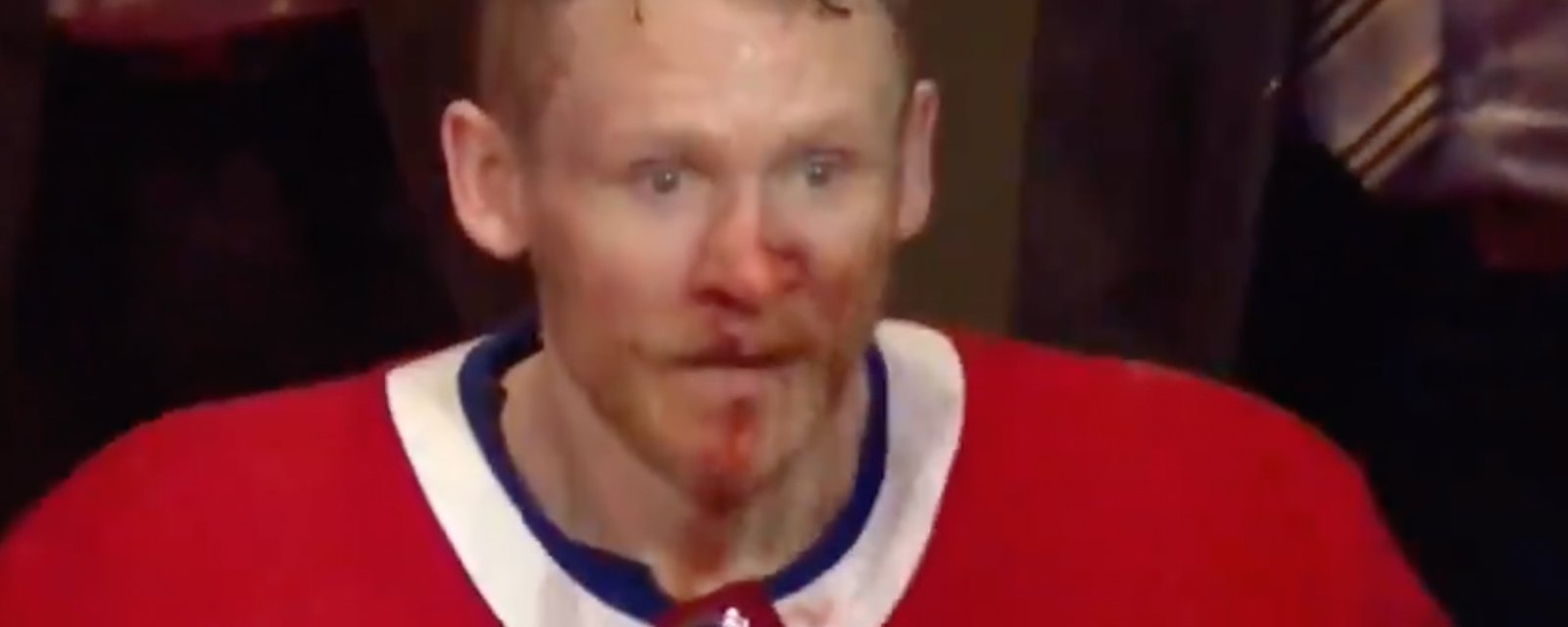 Bloodied Perry comes out of medical room to congratulate teammates in powerful series moment! 