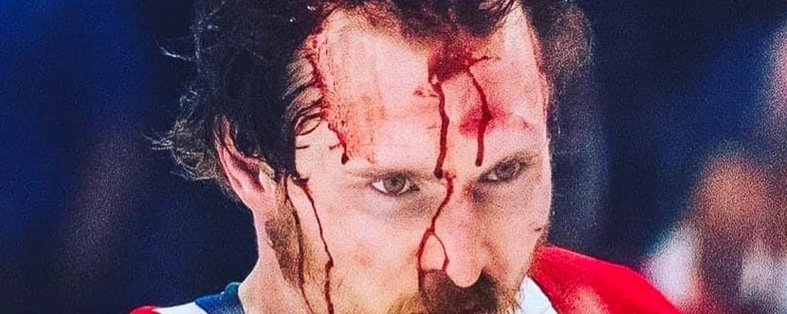 Habs provide update on bloody Gallagher for Game 2