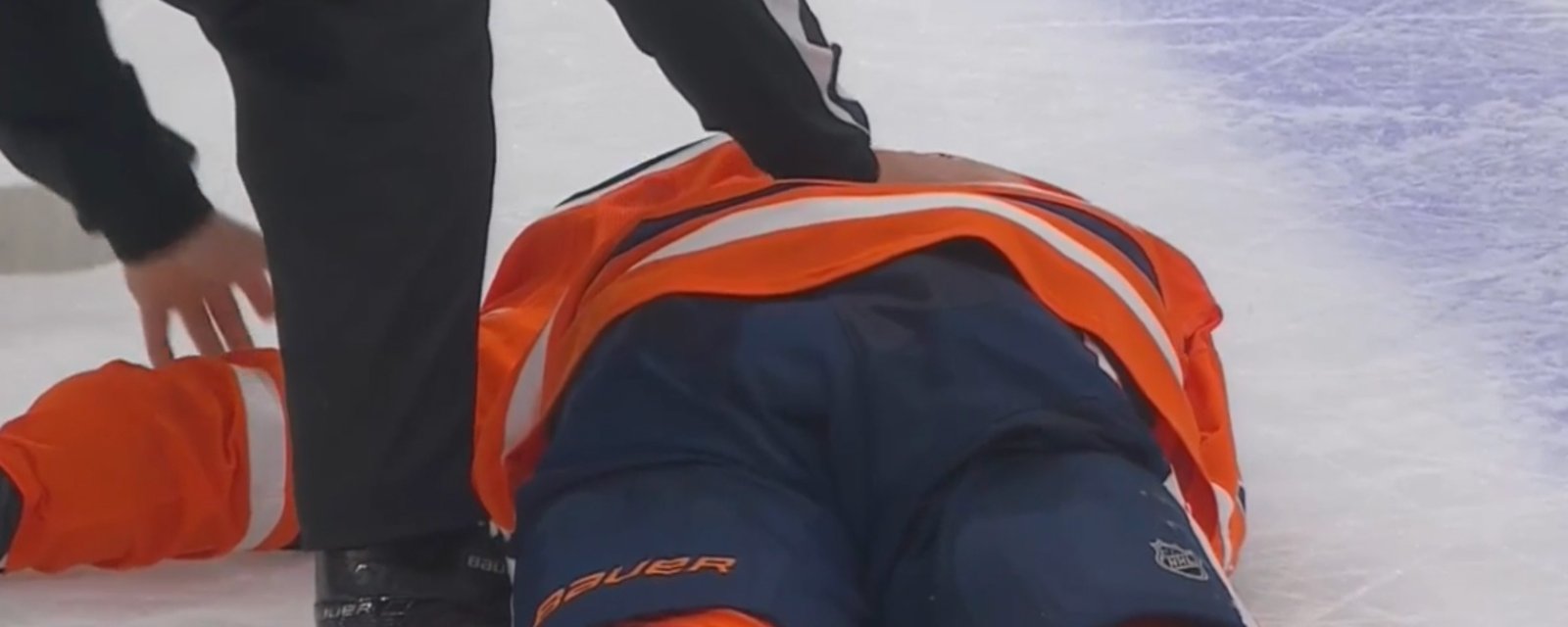 Zack Kassian smashes his head on the ice during fight