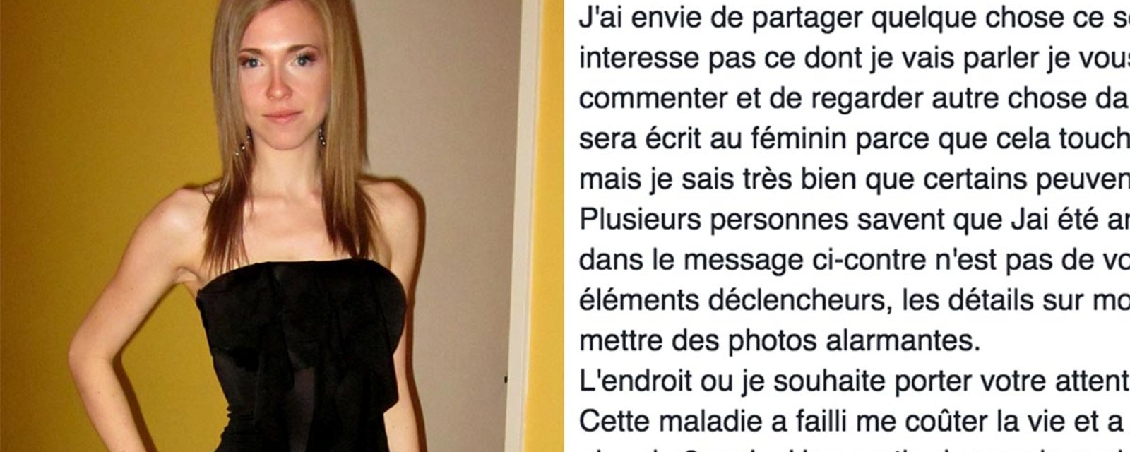Une ex-anorexique québécoise lance un cri du coeur sur Facebook... Aujourd'hui, elle est méconnaissable!
