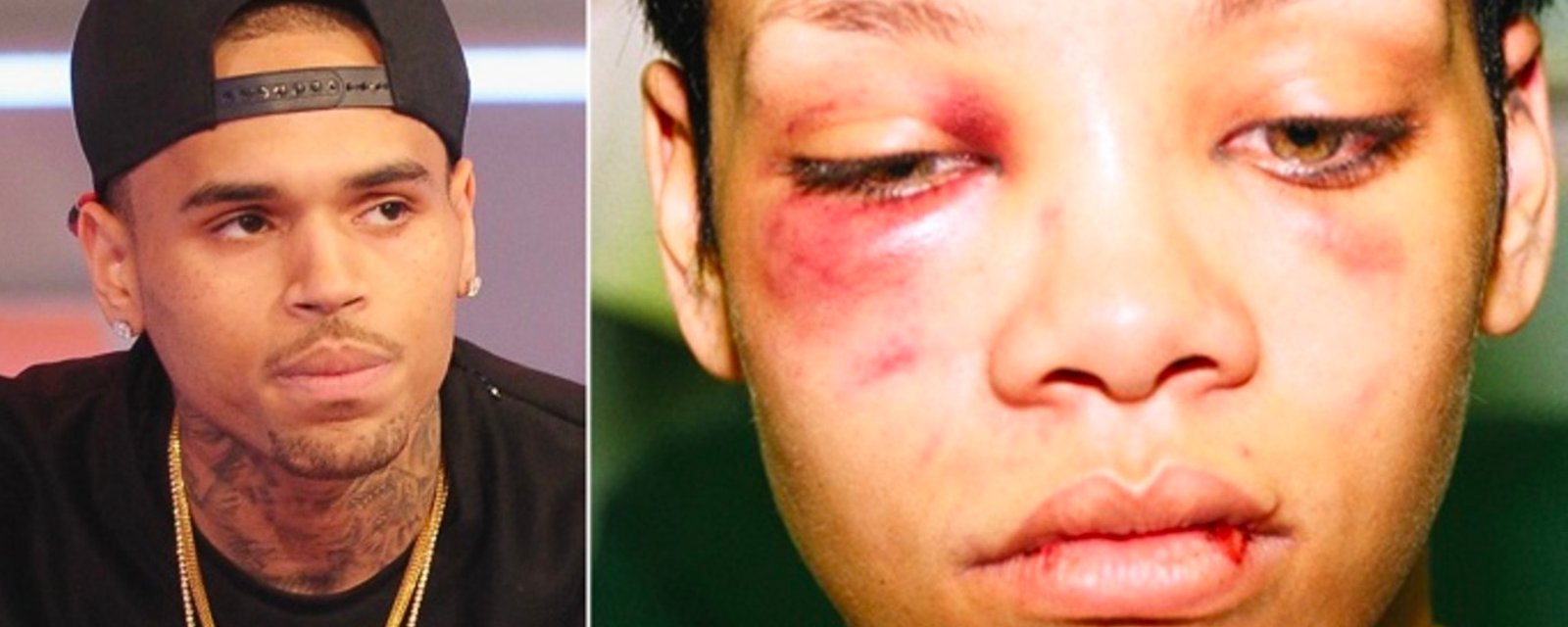 Chris Brown raconte la nuit où il a tabassé Rihanna