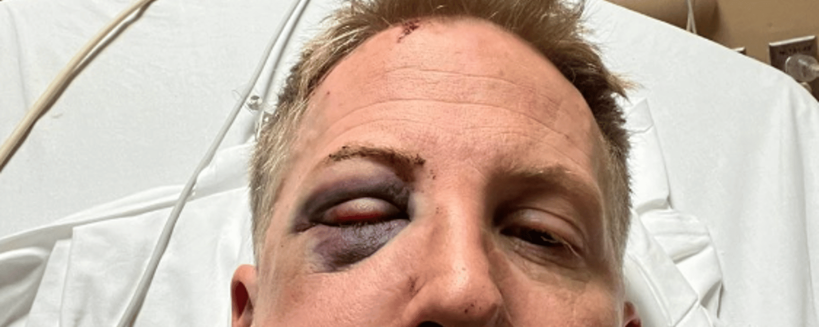 Un fan de Vegas hospitalisé après avoir été agressé par un fan des Stars