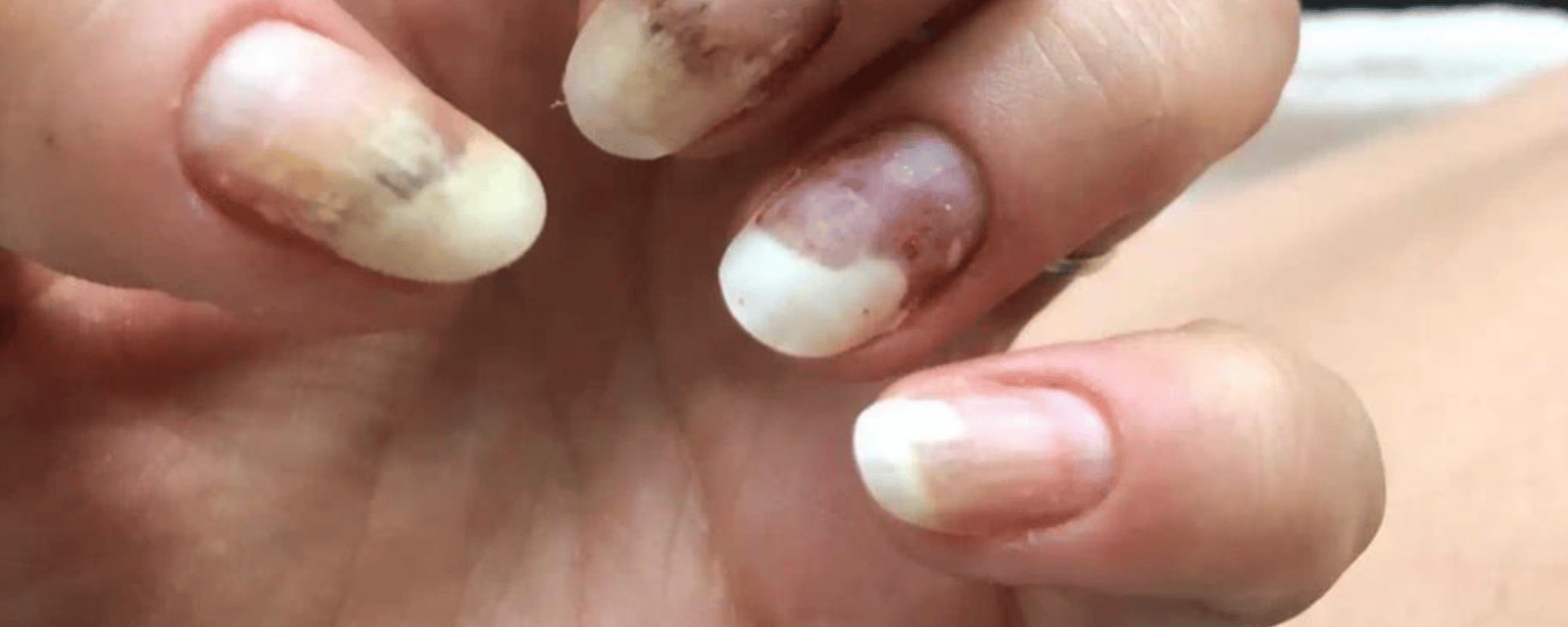 Une entreprise québécoise de vernis à ongles dans la mire de Santé Canada après de nombreux incidents inquiétants