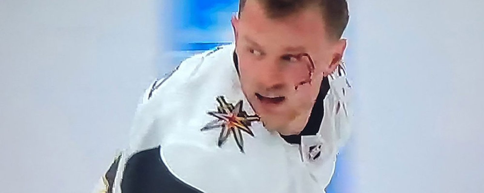 Eichel takes a shot to the face, leaves the game leaking badly all over the ice