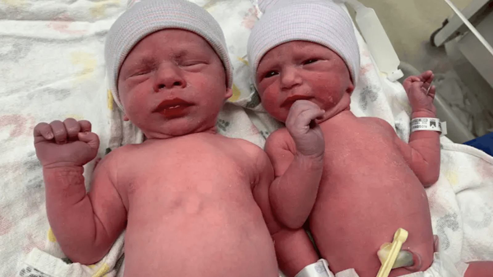 Ces jumeaux  sont nés d'embryons congelés de 30 ans.