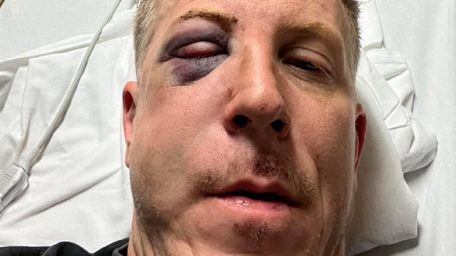 Fan brutally assaulted during Stanley Cup playoff game.