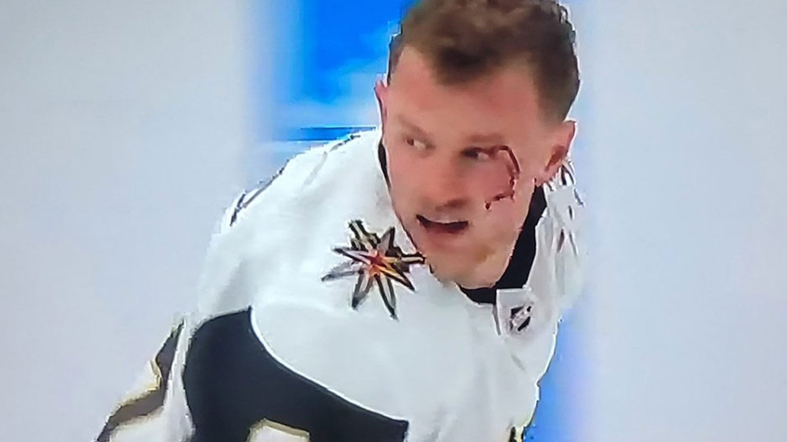Eichel takes a shot to the face, leaves the game leaking badly all over the ice
