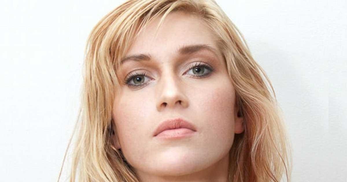 [PHOTOS] Elle se fait enlever 6 côtes pour ressembler à une célébrité... Monde de Stars