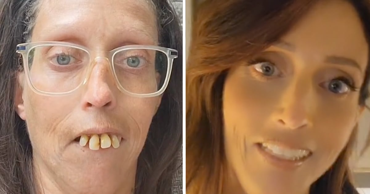Une Québécoise n'a plus honte de son sourire grâce à la générosité des internautes