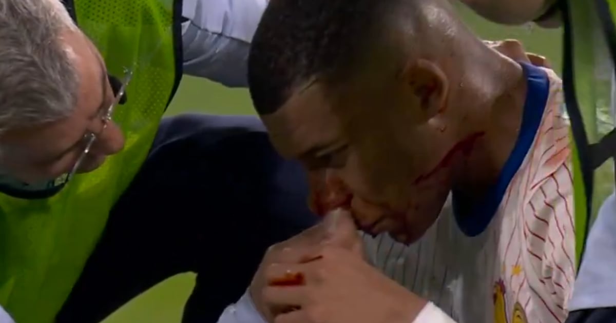 On en sait davantage sur la blessure de Kylian Mbappé et il va devoir se faire opérer