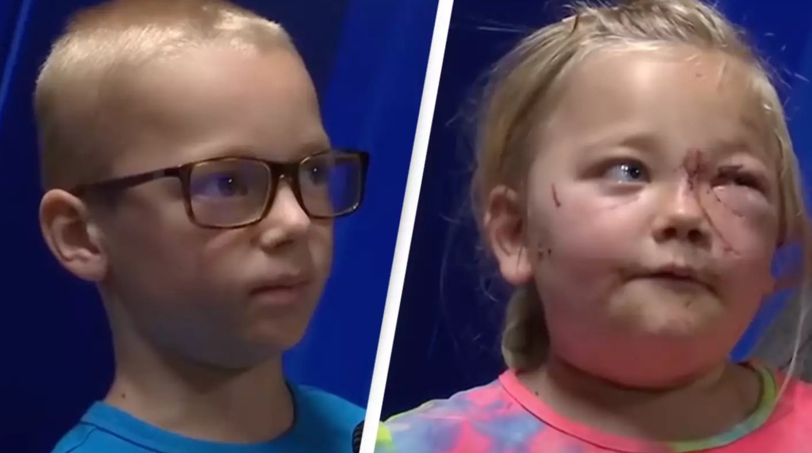 À 8 ans, il sauve sa petite soeur d'une attaque de pitbull