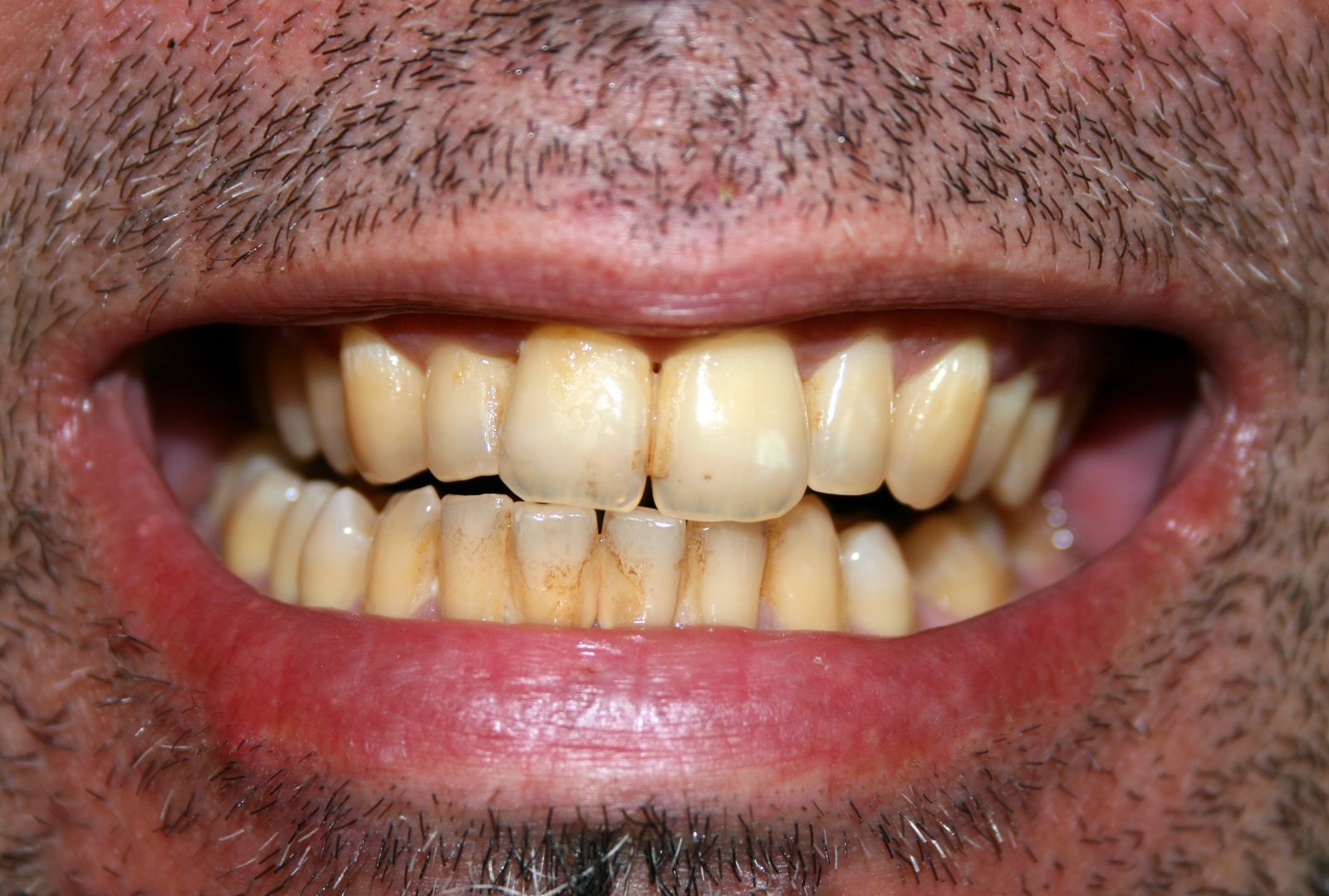 Une dentiste dévoile trois choses à éviter afin que vos dents ne jaunissent pas.