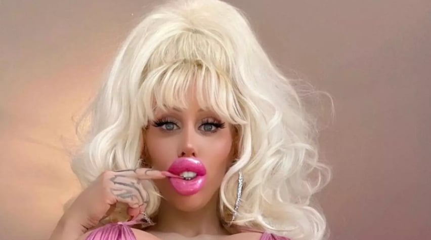 La femme qui a flambé plus de 100 000$ pour ressembler à une poupée dévoile à quoi elle ressemblait avant