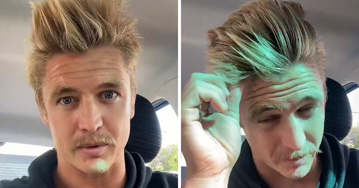Pour que ses cheveux cessent de tomber, il a arrêté de se laver les cheveux pendant 6 ans