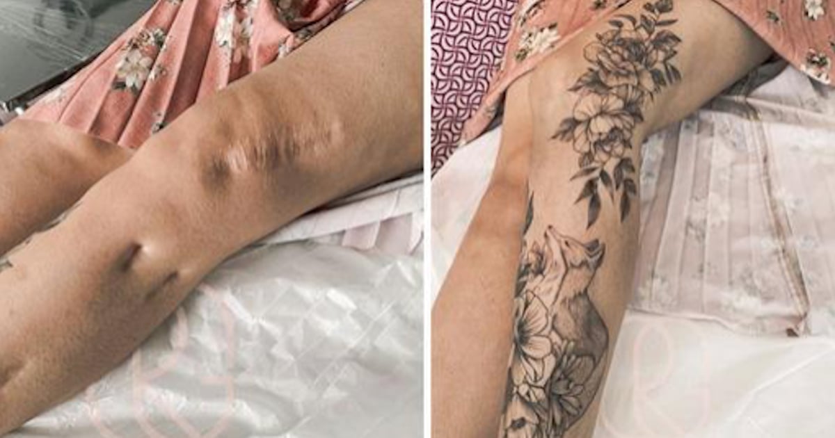 Deux tatoueuses métamorphosent des cicatrices en véritables oeuvres d’art