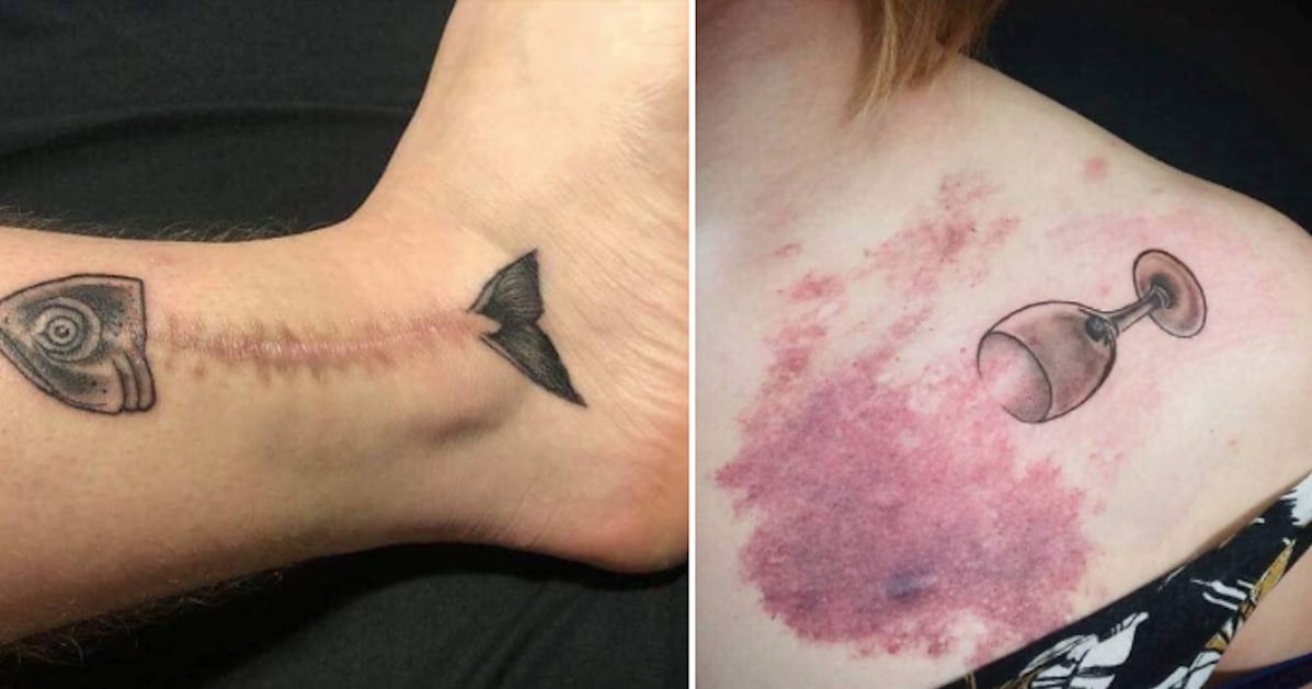 14 magnifiques tatouages qui camouflent (ou mettent en valeur) des taches et des cicatrices
