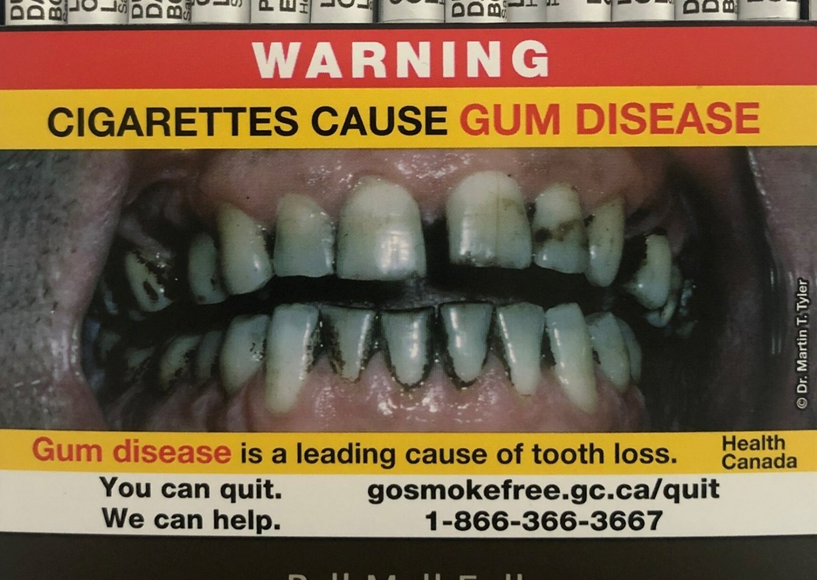 Le Canada devient le premier pays au monde avec de tels avertissements sur les cigarettes 