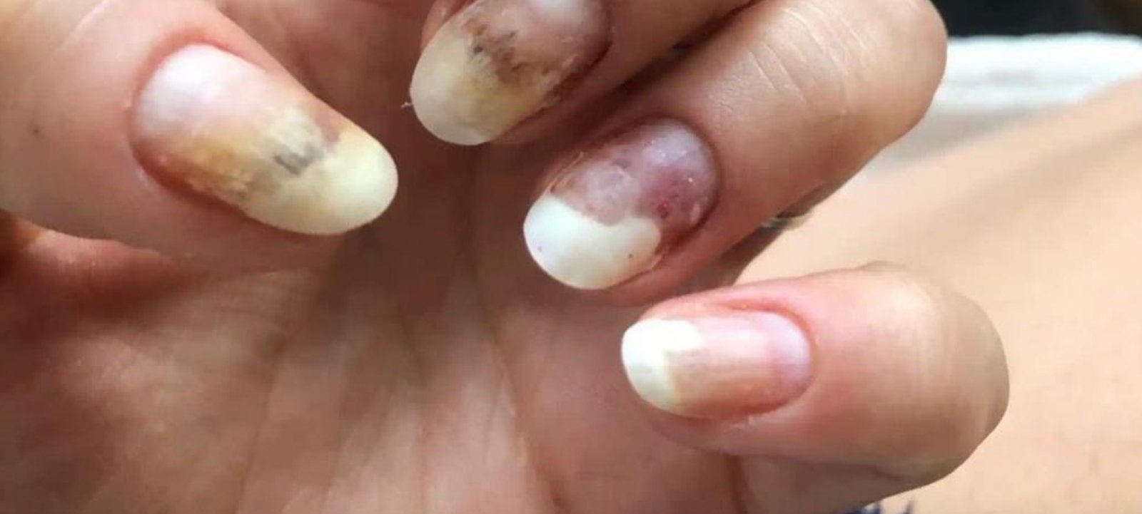 Une entreprise québécoise de vernis à ongles dans la mire de Santé Canada après de nombreux incidents inquiétants