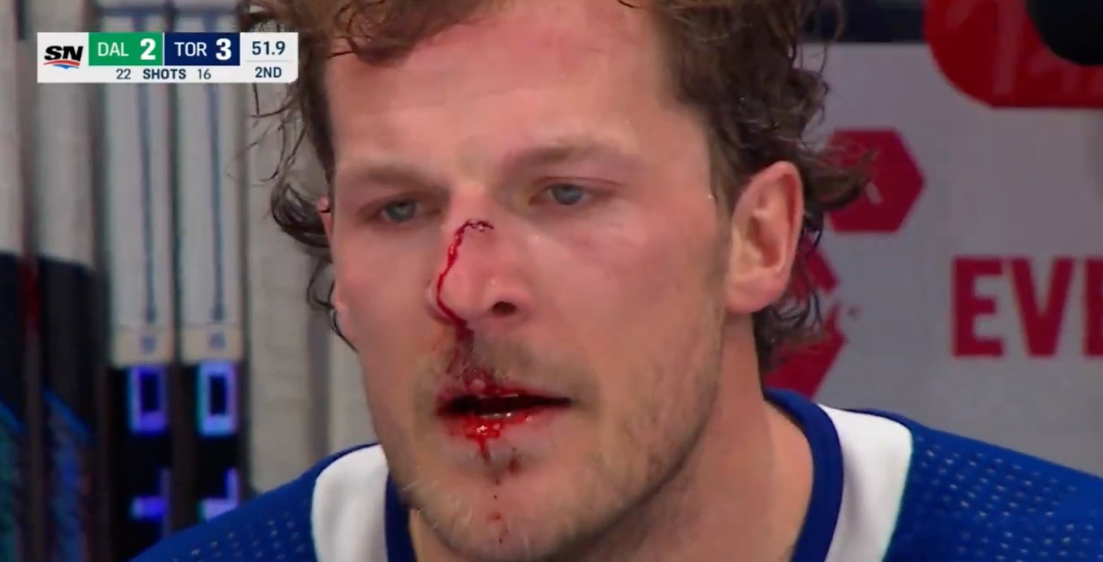 Bloodied Jake McCabe EXPLODES on referees after late blindside hit 